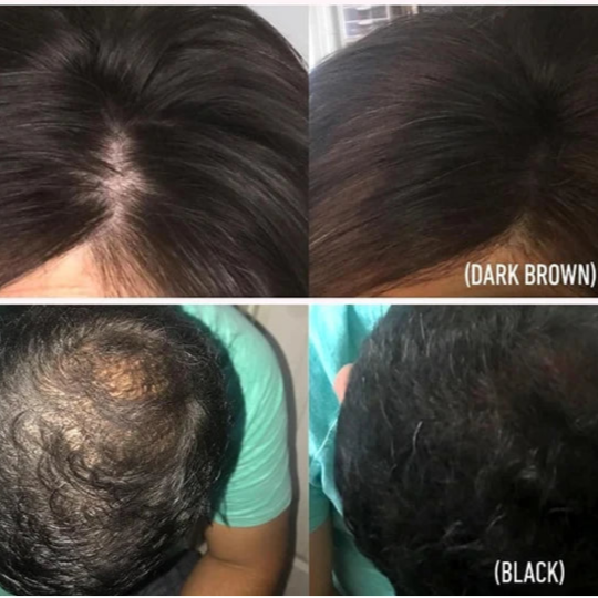 HairMagic Secret - Cobertura instantânea para seus cabelos